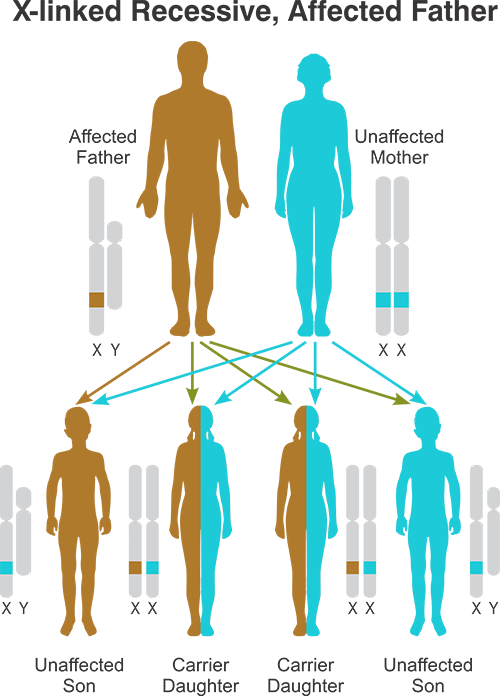 X-linked Recessive Affected Father