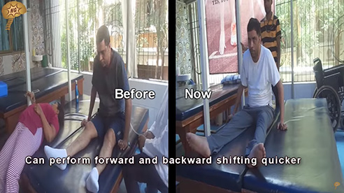 Spinal Cord Injury Testimonial