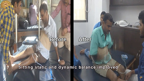 Spinal Cord Injury Testimonial