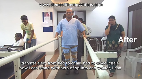 Spinal Cord Injury Testimonial