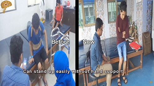 Spinal Cord Injury Testimonial